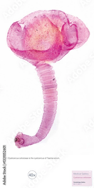 Fototapeta Porcine cysticercosis is the cysticercus of the tapeworm Taenia solium, which can parasitize the human brain, skin, and eyes, leading to the occurrence of diseases.Magnify 40x.
