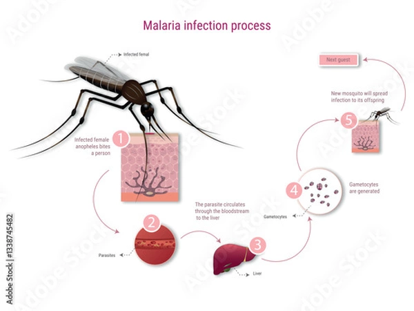 Obraz Malaria infection process explained with mosquito biting person