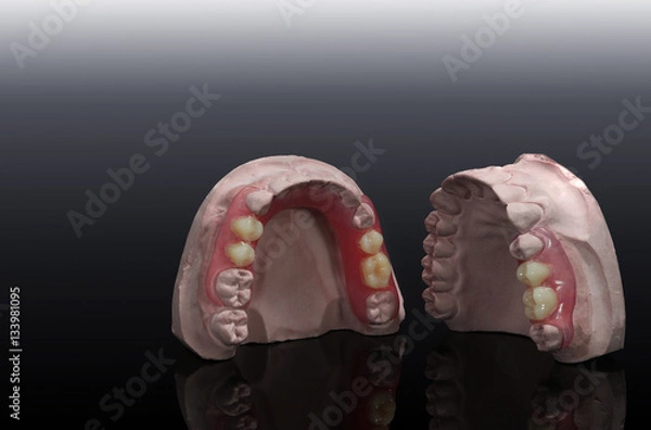 Obraz two tempolaryplate denture