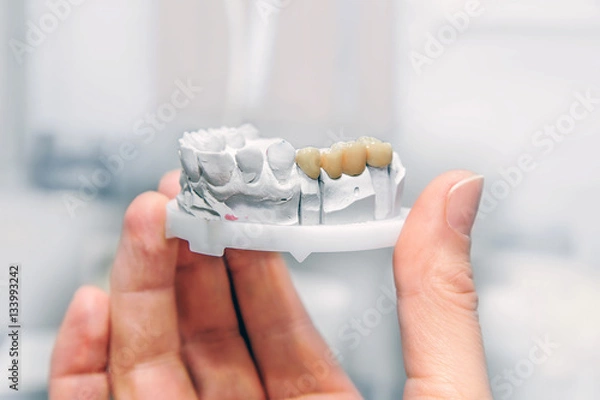 Obraz Technical shots on a dental prothetic laboratory