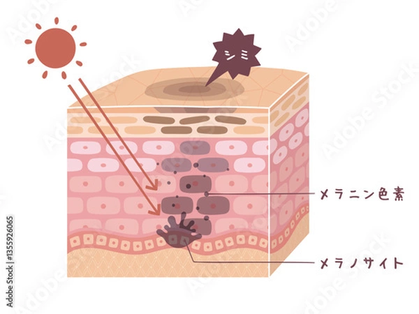 Obraz 肌の断面図で見るシミが出来る図解イラスト