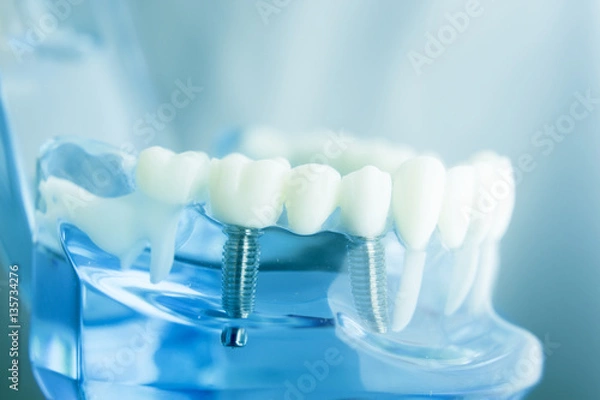 Obraz Dental teeth dentistry model