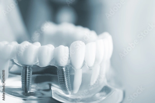 Obraz Dental teeth dentistry model