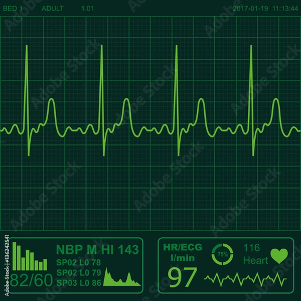 Fototapeta Heart monitor