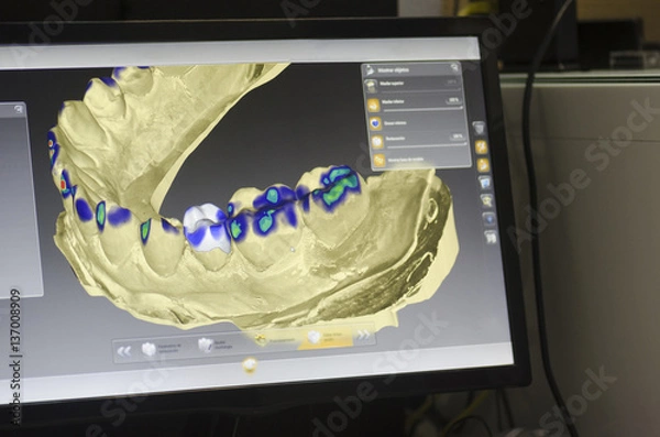Fototapeta Technik dentystyczny projektuje koronę dentystyczną za pomocą komputera.