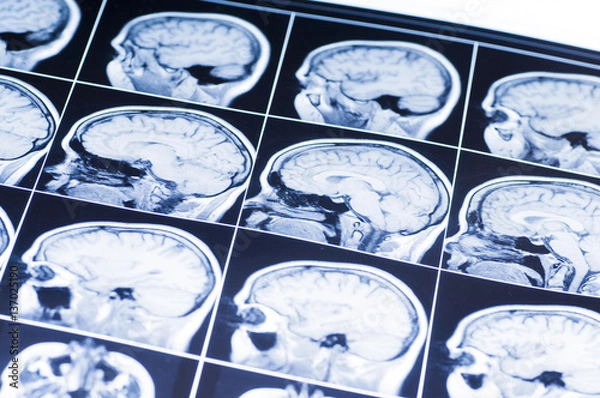 Obraz MRI of the brain. snapshot