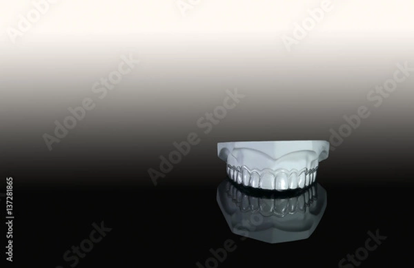 Obraz Clear retainer in model