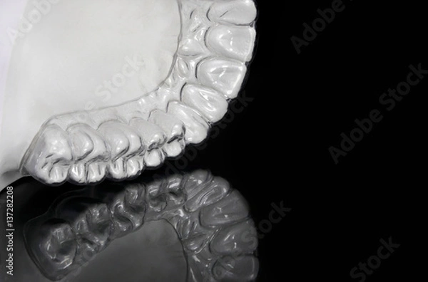 Obraz Clear retainer reflex