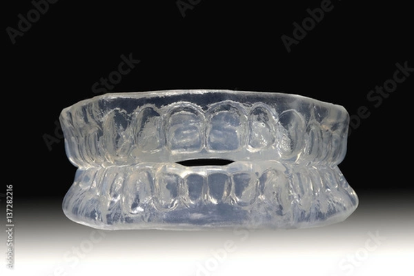 Obraz positioner splint