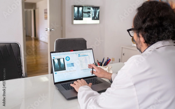 Fototapeta a doctor wearing a white coat types on his laptop. There is a generic health care software with x rays on the screen. In the background a viewing box with some x-rays and the corridor