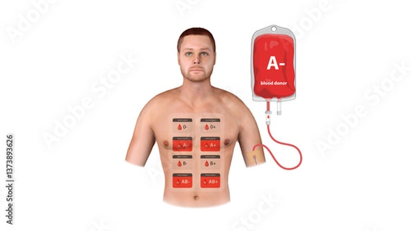 Obraz A medical infographic displaying A Negative blood donation, transfusion process, and compatibility with different recipient blood types, 3d