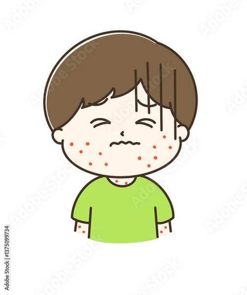 Obraz 赤い発疹が出ている男の子の上半身のゆるかわイラスト