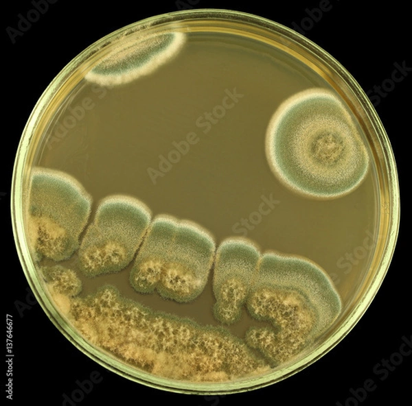 Obraz Colonies of of allergic mould from air spores and/or biologically damaged constructions on a petri dish (agar plate) manually isolated on a black background. Focus on full depth.