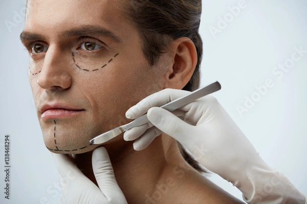 Fototapeta Handsome Man With Lines On Face Before Plastic Surgery