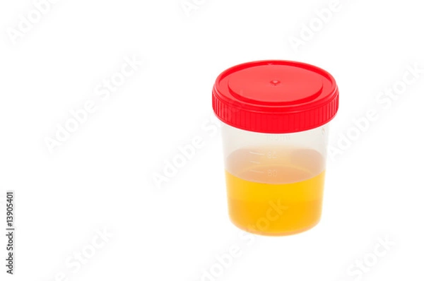Obraz Urine