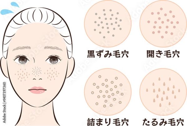 Obraz 鼻の毛穴トラブル4種類セット｜たるみ・詰まり・黒ずみ・開き毛穴のイラスト素材