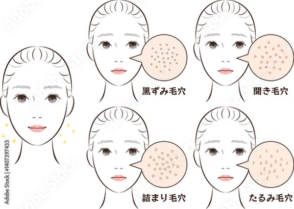 Obraz 鼻の毛穴トラブル4種類セット｜たるみ・詰まり・黒ずみ・開き毛穴のイラスト素材
