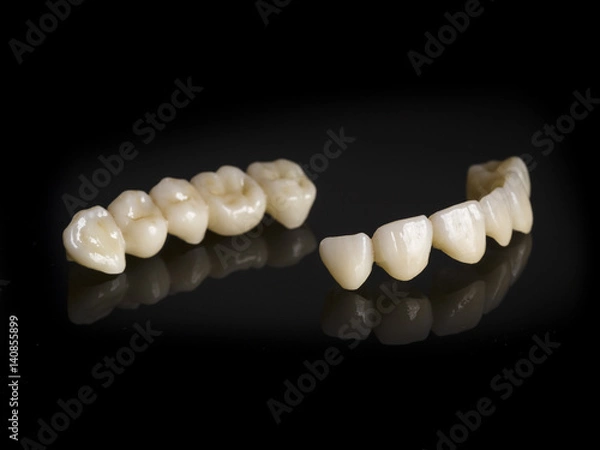 Fototapeta Monolithic zirconia restorations full arch implant supported with the ceramic load in vestibular, back background