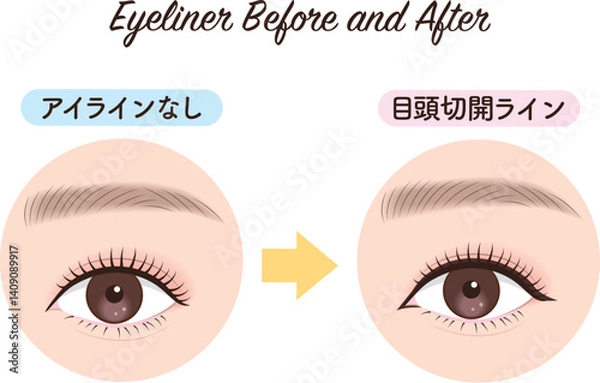 Obraz アイライン　ビフォーアフター　目頭切開ライン