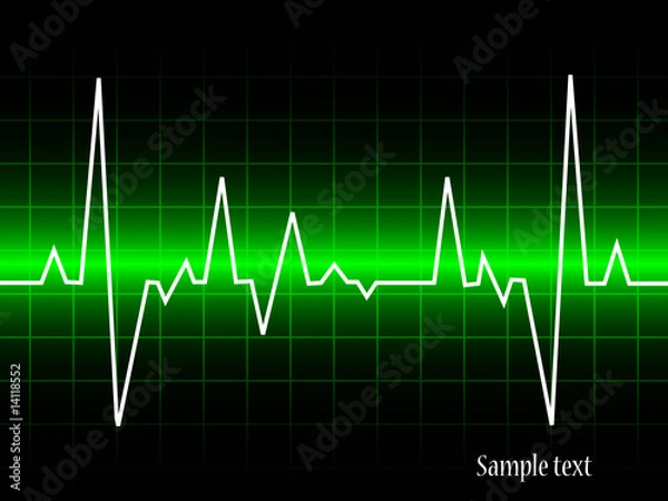 Obraz electrocardiogram- vector illustration