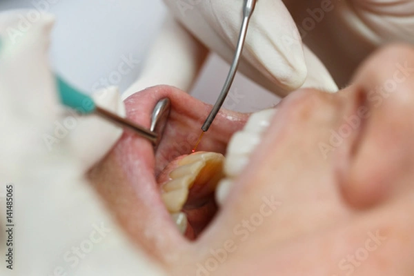 Obraz Laser dentystyczny stosowany u pacjenta