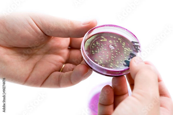 Obraz Escherichia coli