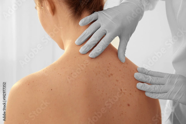 Obraz Dermatolog bada pacjenta w klinice, zbliżenie