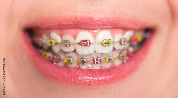 Obraz Close-up shot of multicolored bracket systems