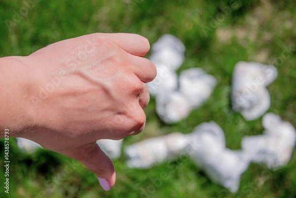 Obraz Diaper waste, dirty diapers. Disposal. The impact of disposable diapers on the environment.