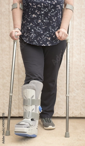 Fototapeta Unrecognisable woman wearing a medical orthopaedic boot with cruches
