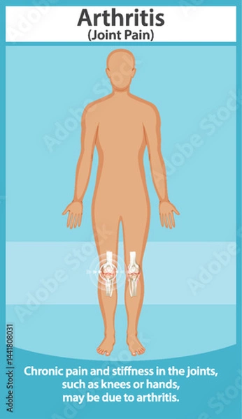 Obraz Understanding Arthritis and Joint Pain