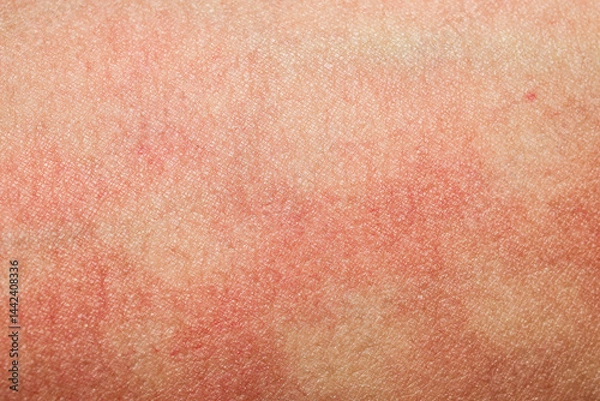 Fototapeta human skin texture