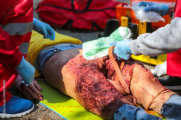 Obraz Doctors of emergency care, issuing of first aid to victim of a terrorist attack, an explosion, damage to both legs with heavy bleeding