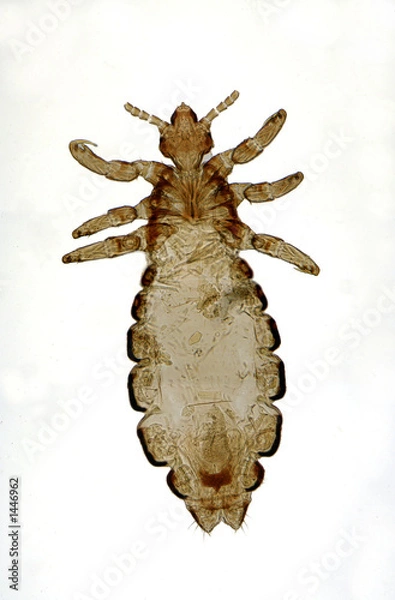 Fototapeta head lice