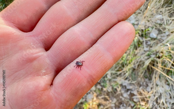Obraz Tick crawls on a man's hand. Tick crawling along a person's hand. Encephalitis mite. Tick-borne encephalitis (TBE) is a viral infection spread by tick bites. Virus by ticks.