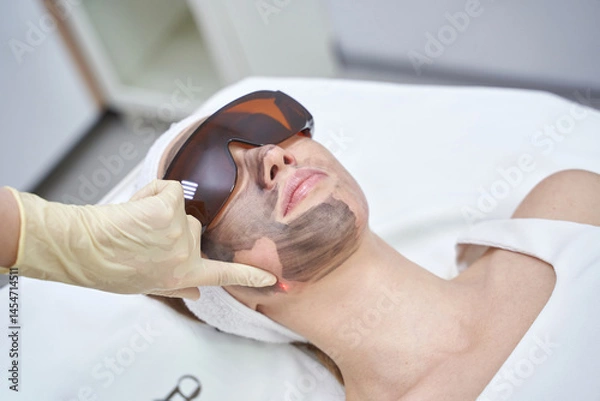 Fototapeta Young caucasian female undergoes laser treatment with protective goggles in spa setting.