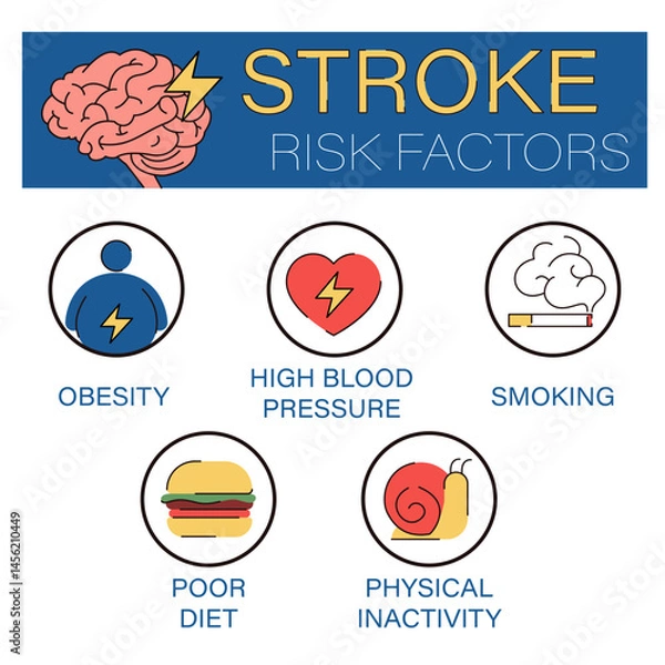Obraz Stroke risk factors infographic vector isolated. Illustration of factors that cause brain stroke. Medical condition, stroke awareness infographic.