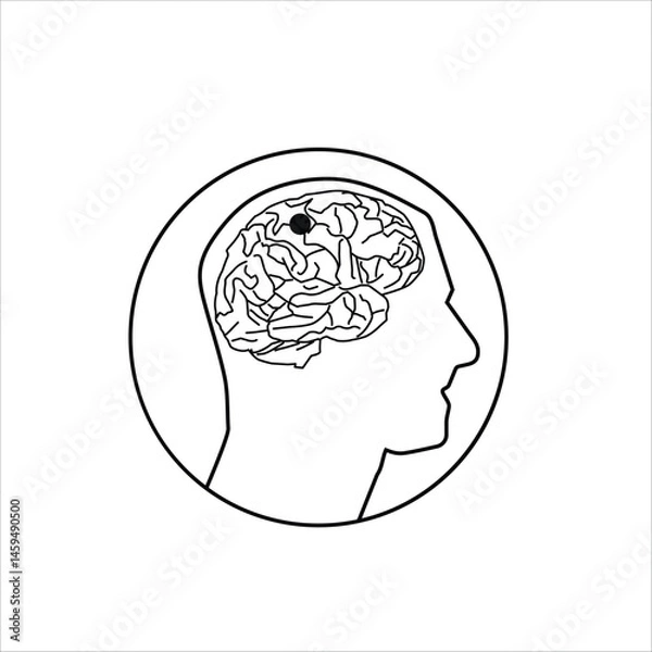 Fototapeta Brain tumor concept thin line illustration. brain in the head. vector icon