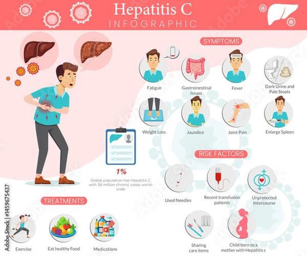 Fototapeta Illustrated Hepatitis C Guide with Key Facts and Stages