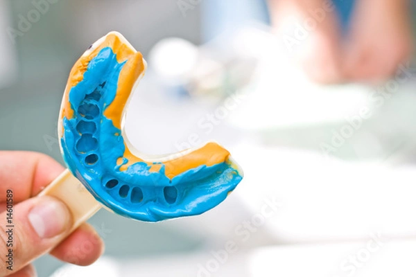 Obraz Odcisk dentystyczny