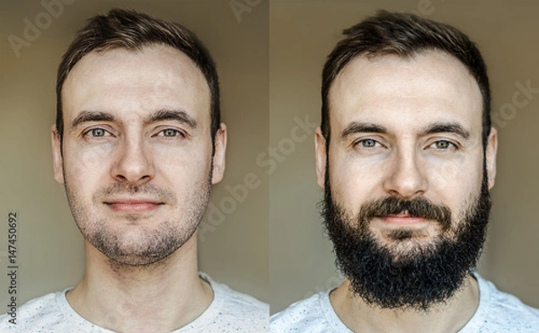 Obraz A collage of a beautiful portrait of a man with a full beard and no beard after shaving with light stubble. Barber working on a brown background.