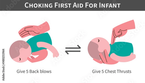 Fototapeta Choking First Aid For Infant cartoon illustration . Back blows and switch with chest thrusts . Flat design . Vector .