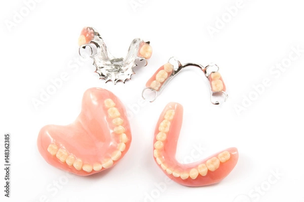 Obraz removable partial denture on white background.