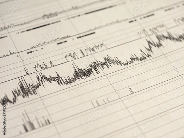 Obraz polysomnography (PSG) sleep study