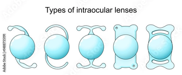 Fototapeta Types of intraocular lenses in Cataract surgery.