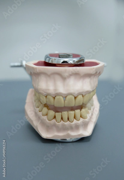 Obraz a cast model of human teeth that is used in the dental field