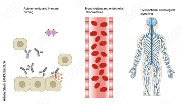 Obraz Multi-System Pathophysiology: Autoimmunity, Coagulation & Neurological Dysfunction