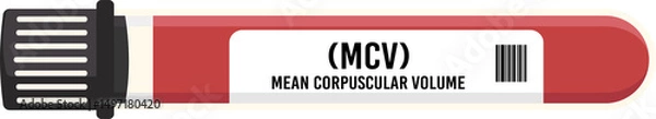 Obraz MCV
