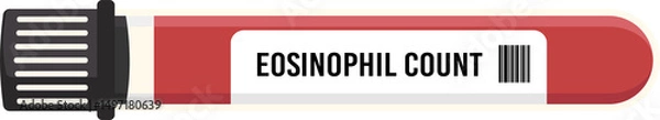 Obraz eosinophil count