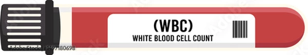 Obraz WBC
